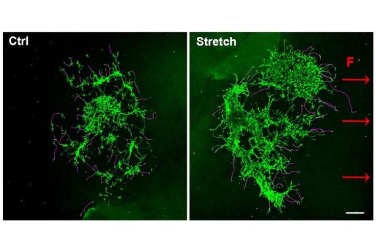 「磁石で神経細胞成長を操る新技術」