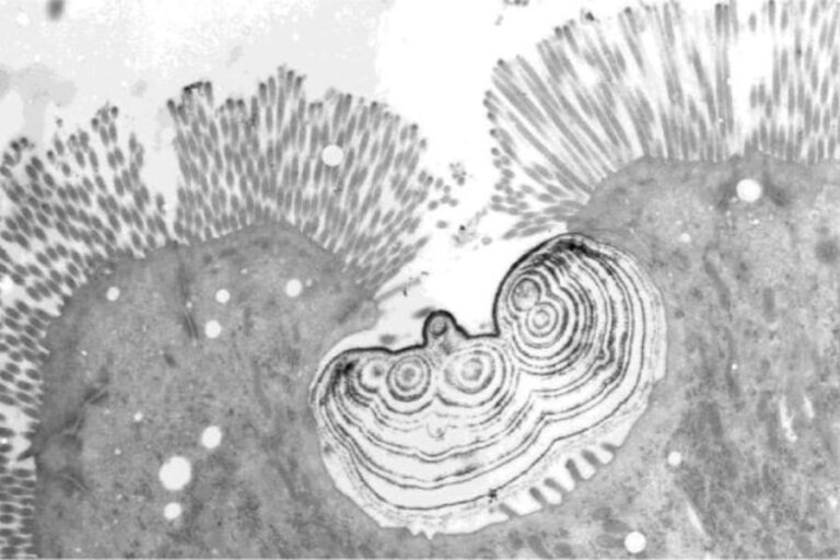 「ニシキヘビ、骨消化細胞発見！」