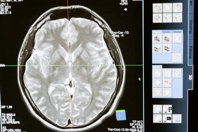 「薬物依存の子ども、脳の違い発覚！」