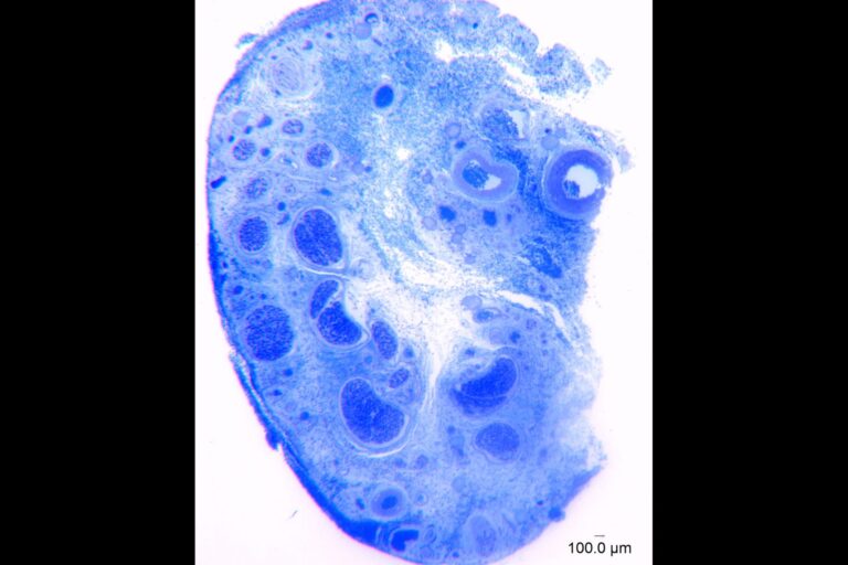 「クリトリス神経線維、1万本超え！」