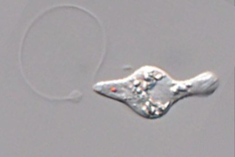 「宿主を食い尽くす！驚愕の寄生ミドリムシ」